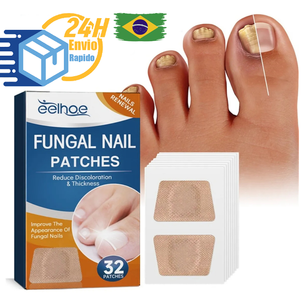 Kit Adesivo Reparador de Unhas dos Pés Cinza Fungo Unha Espessa Correção de Unhas das Mãos Infecção